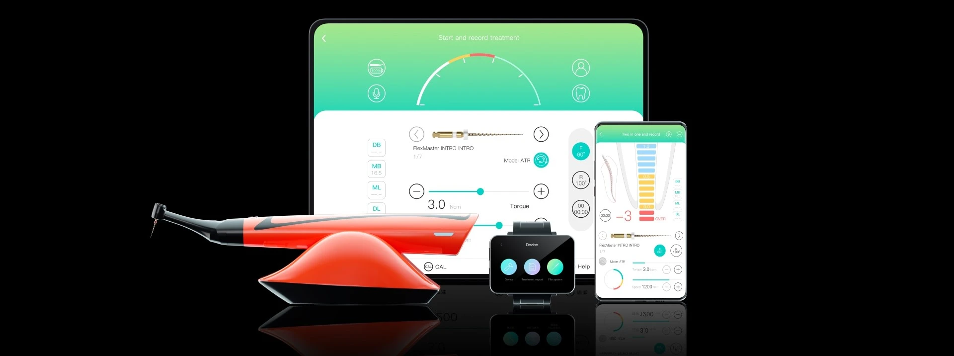 Woodpecker Smart A
