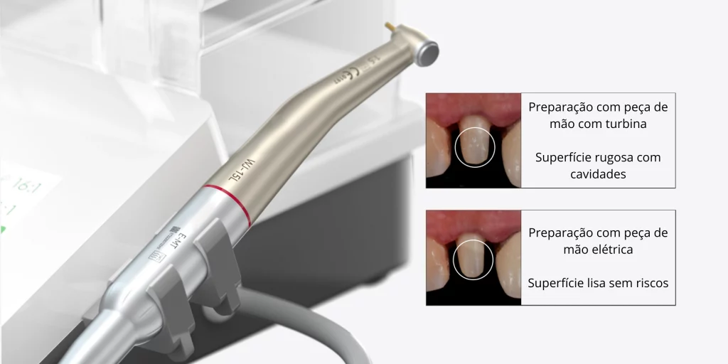 Woodpecker Micromotor MT3