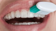 Opalescence PF 16% Kit Paciente
